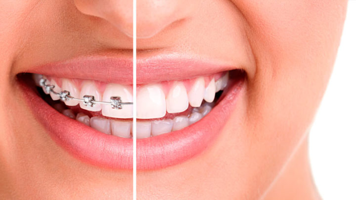 ortodontia-cbo-odontologia